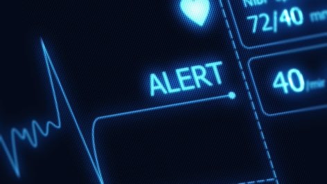 SQL Server Alert